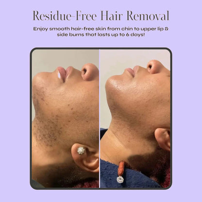 Barenium™ Combo Facial Hair Removal Cream with Post-Waxing Serum