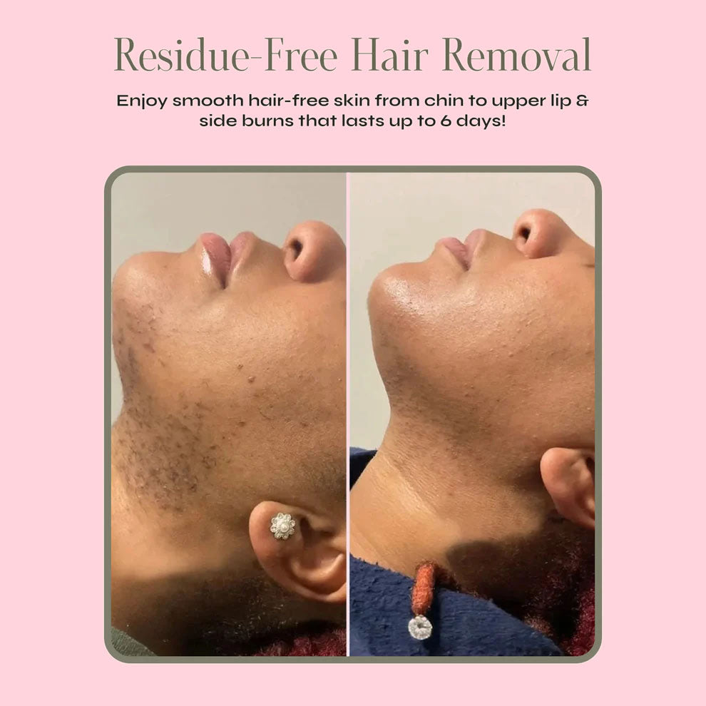Barenium™ Combo Facial Hair Removal Cream with Post-Waxing Serum